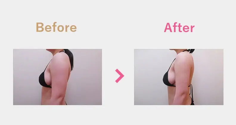 Before After（横）