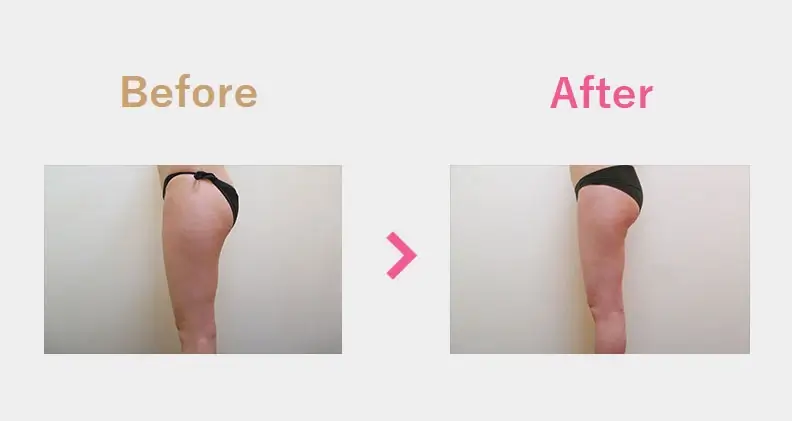 Before After（横）