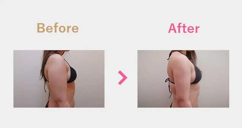 Before After（横）