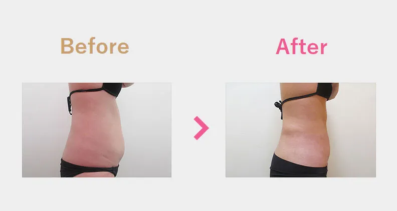 Before After（横）