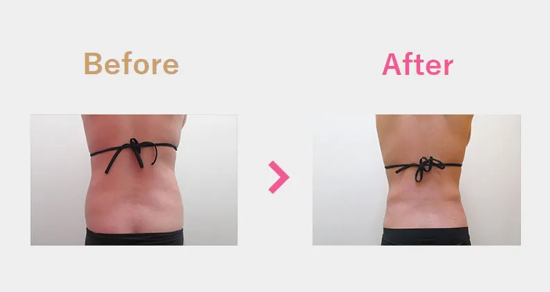 Before After（後）