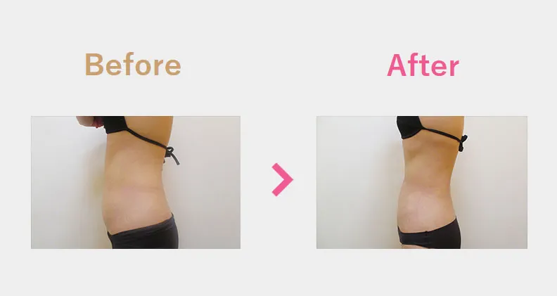 Before After（横）