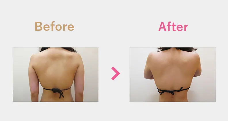 Before After（後）