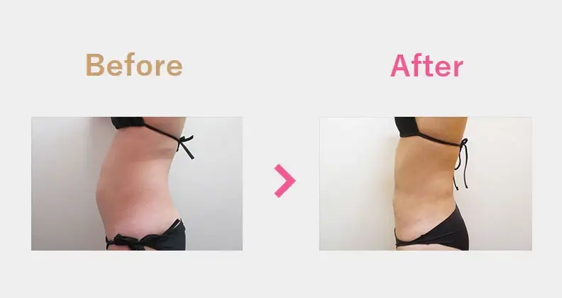 Before After（横）