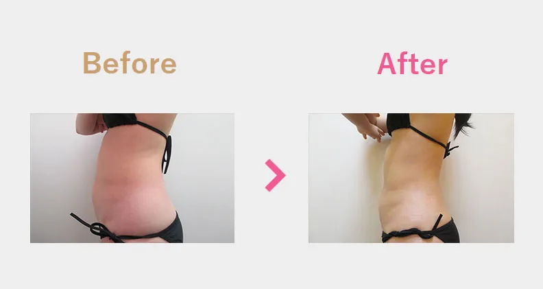 Before After（横）