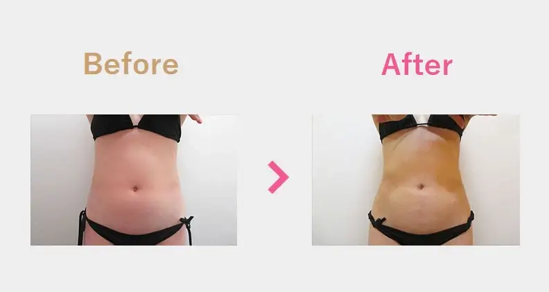 Before After（正面）