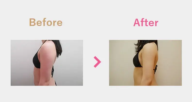 Before After（横）