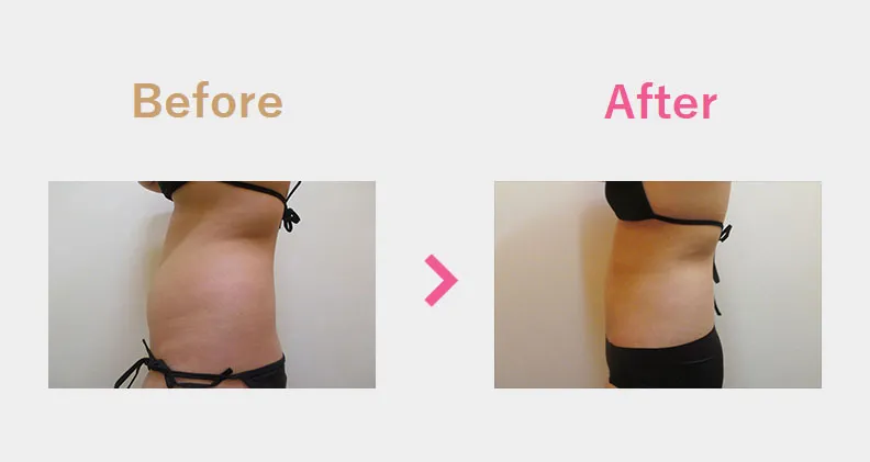 Before After（横）