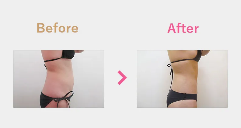 Before After（横）