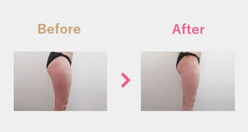 Before After（横）
