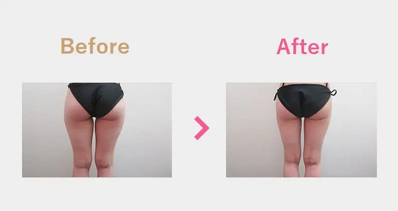 Before After（後）
