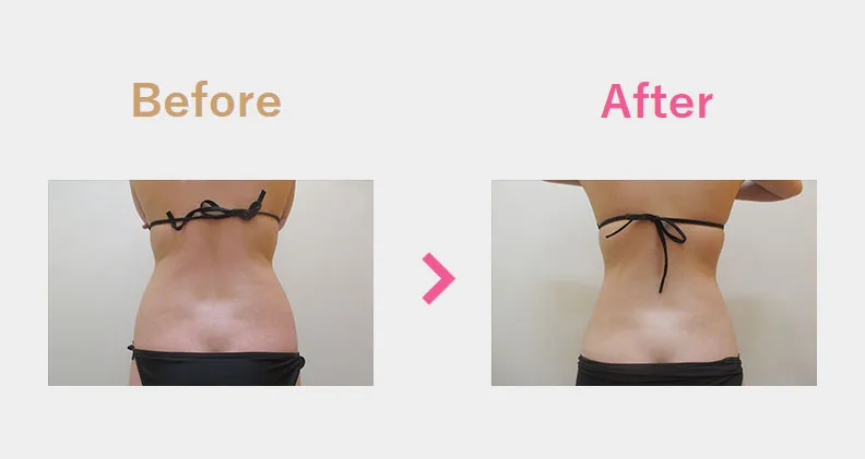 Before After（後）