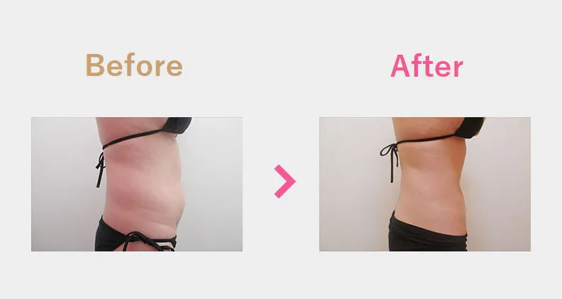 Before After（横）