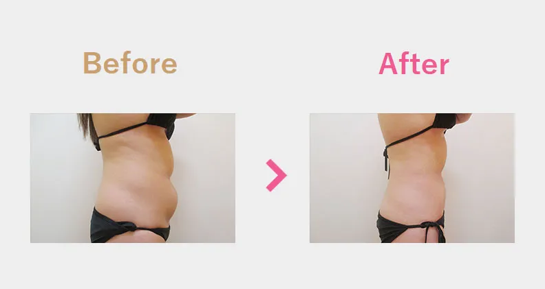 Before After（横）