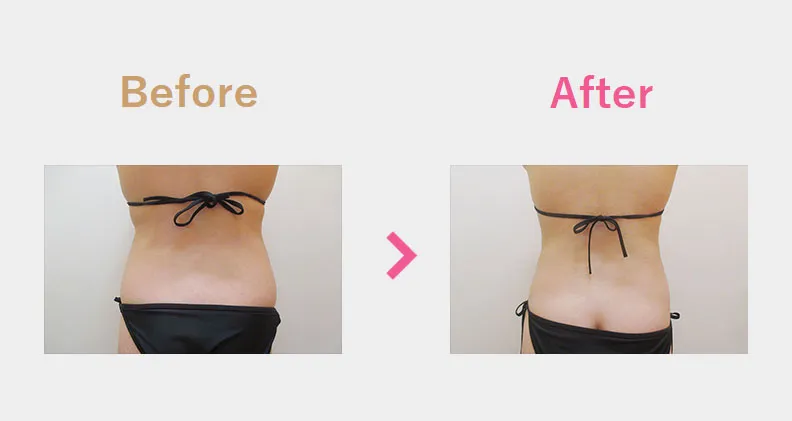 Before After（後）