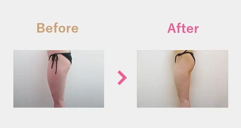 Before After（横）