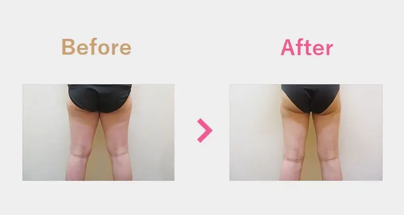 Before After（後）