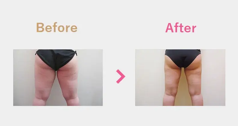 Before After（後）