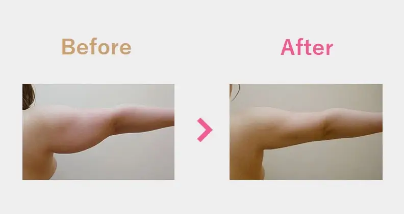 Before After（後）