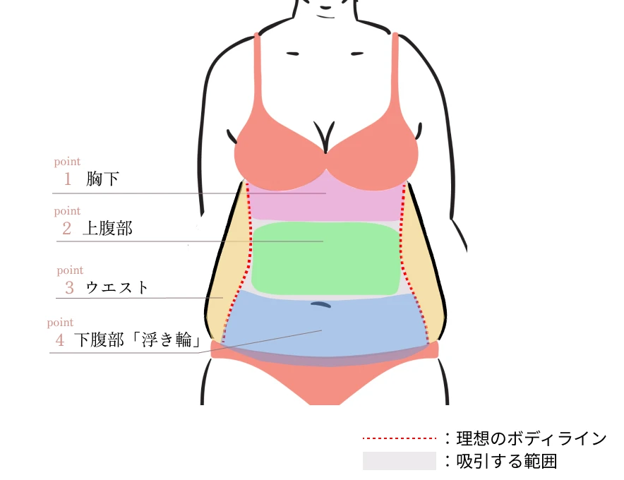 お腹の部位別に解説（イラスト）