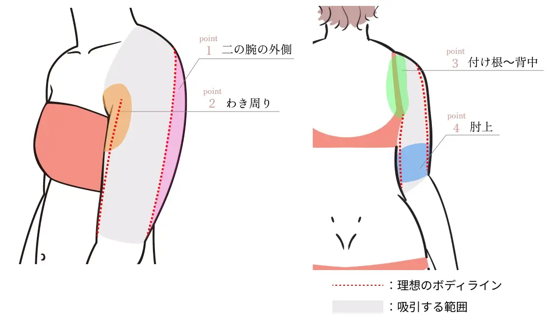 二の腕の部位別に解説（イラスト）