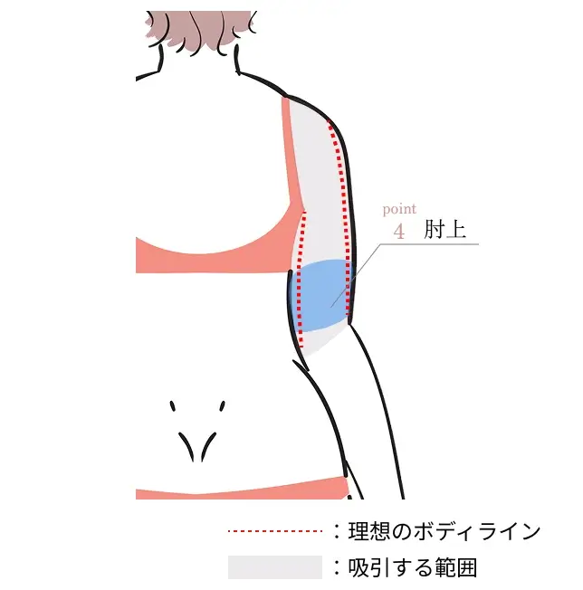 point.4 肘上