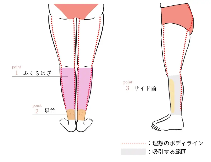 ふくらはぎの部位別に解説