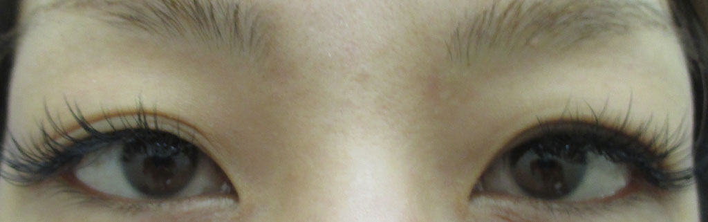 治療前後