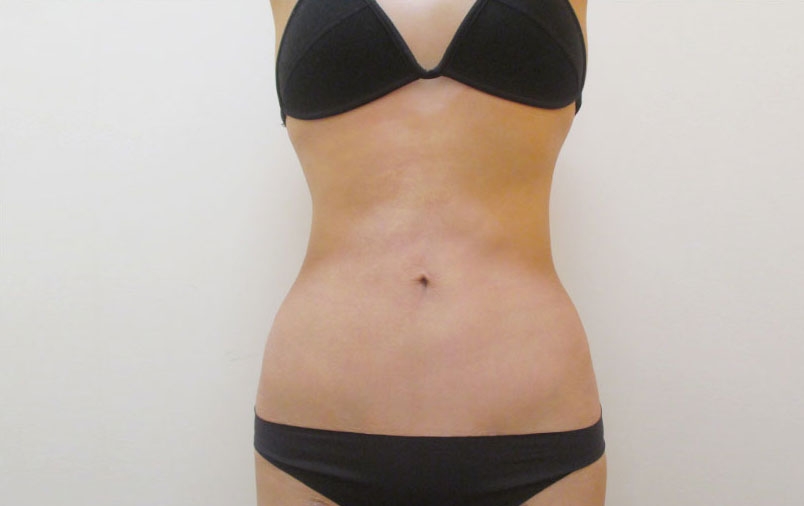 腹部の症例写真一覧
