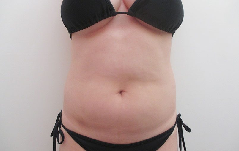 腹部の症例写真一覧