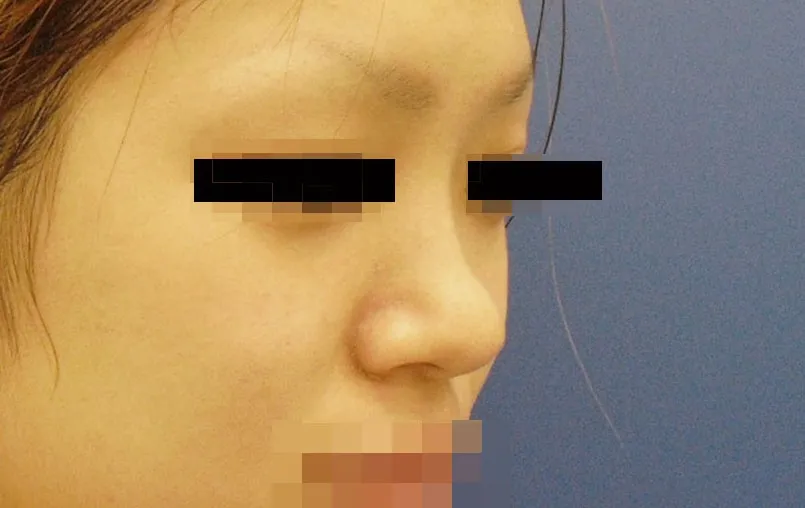 鼻・あごの症例写真一覧