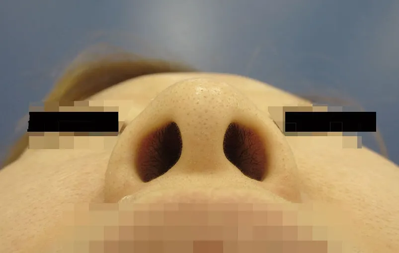 鼻・あごの症例写真一覧