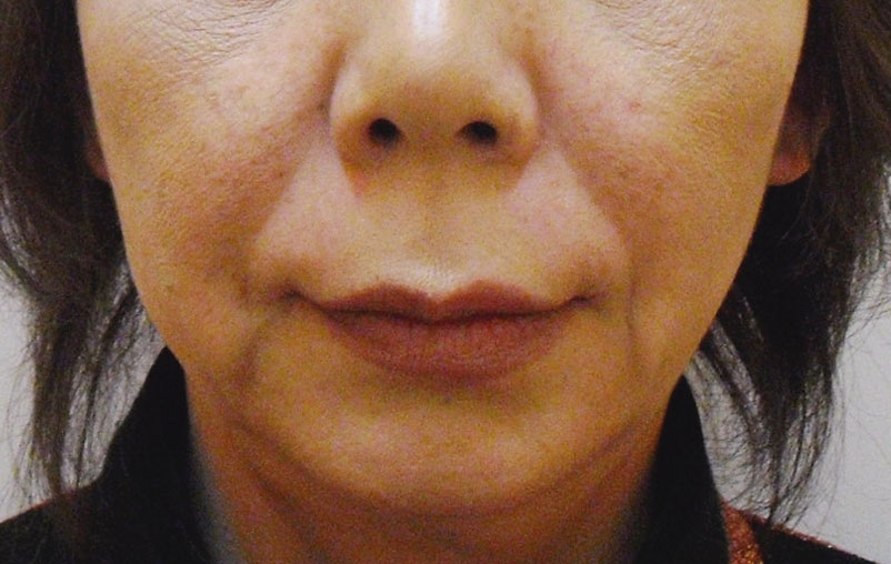 エイジングケアの症例写真一覧
