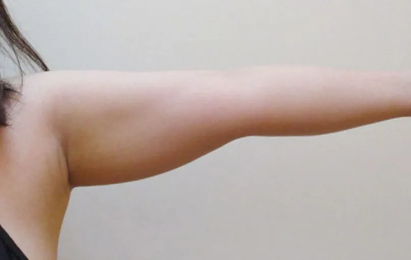 上腕の症例写真一覧