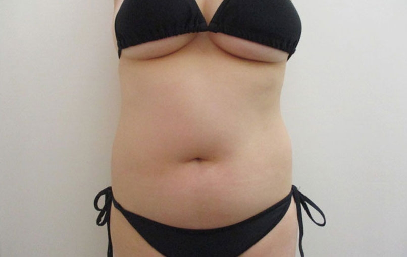 腹部の症例写真一覧