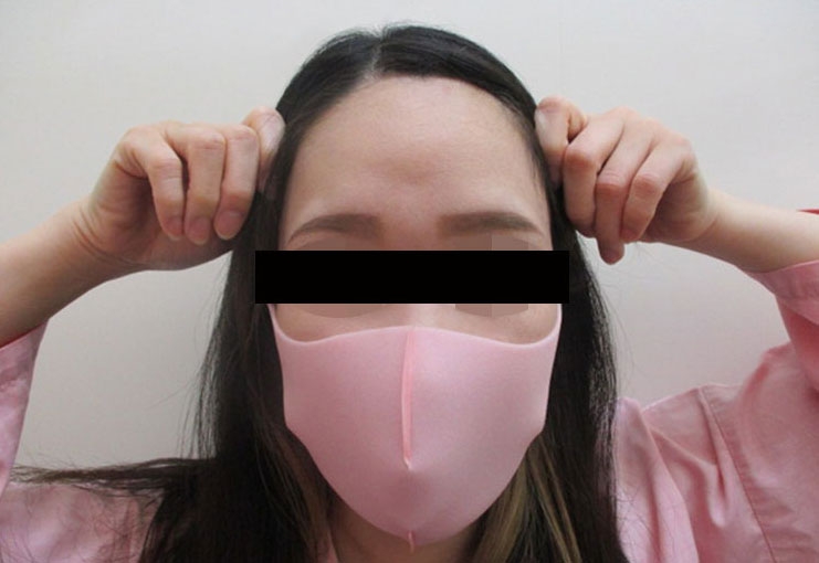 顔の脂肪注入の症例写真一覧