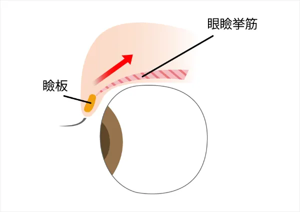 眼瞼挙筋による開眼
