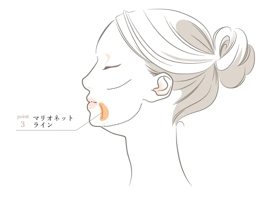 POINT3.マリオネットライン