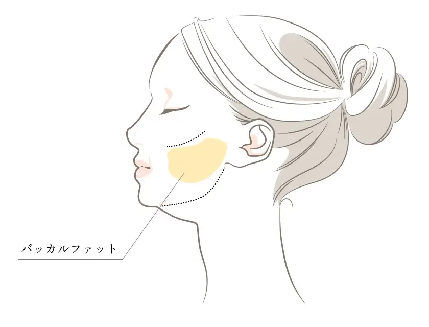 バッカルファット