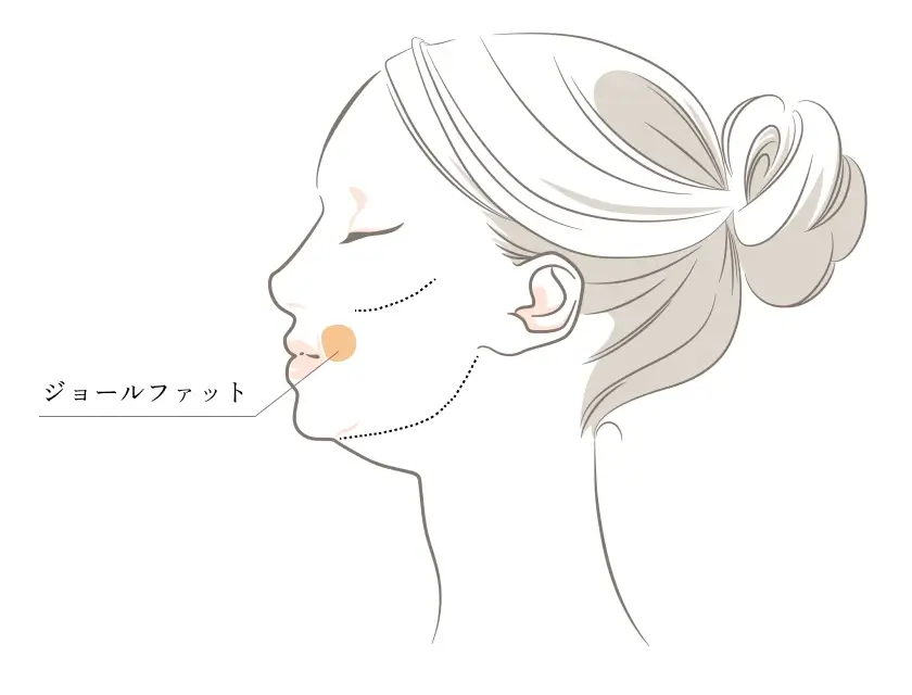 ジョールファット