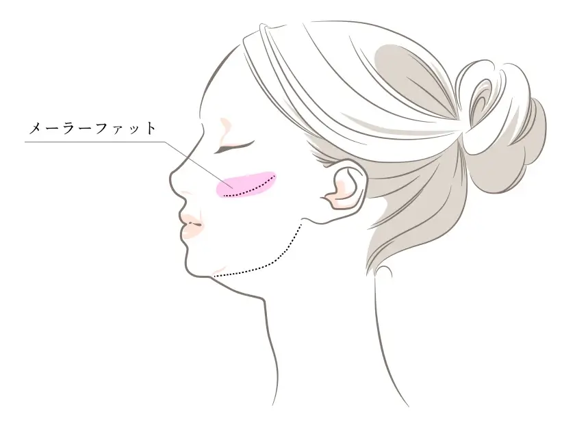 メーラーファット