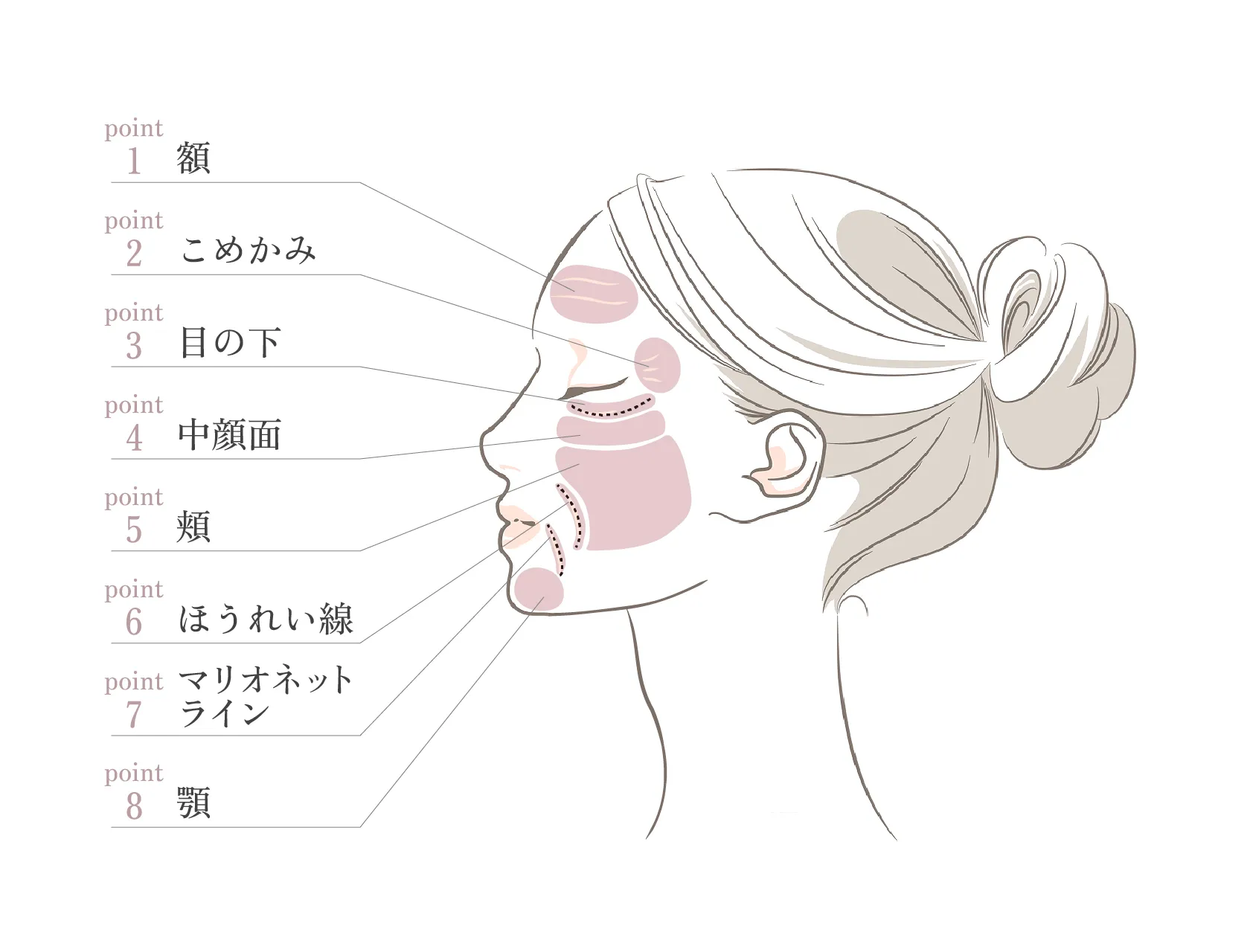 パーツ別・注入ポイントの解説