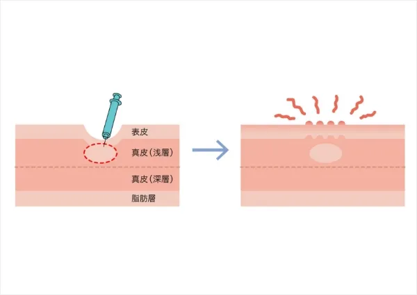 よくある失敗例