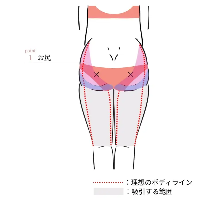 POINT1. お尻