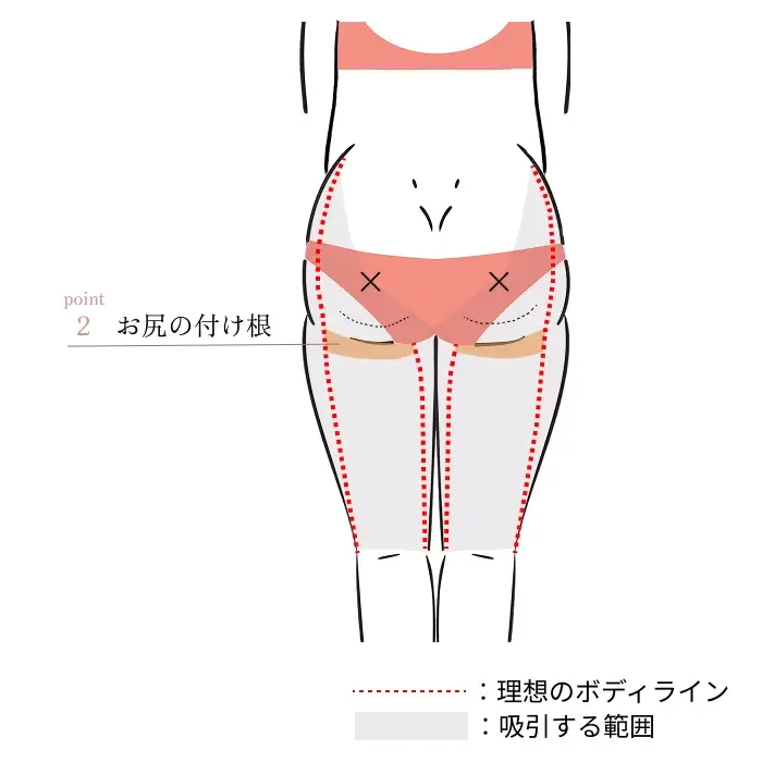 POINT2. お尻の付け根