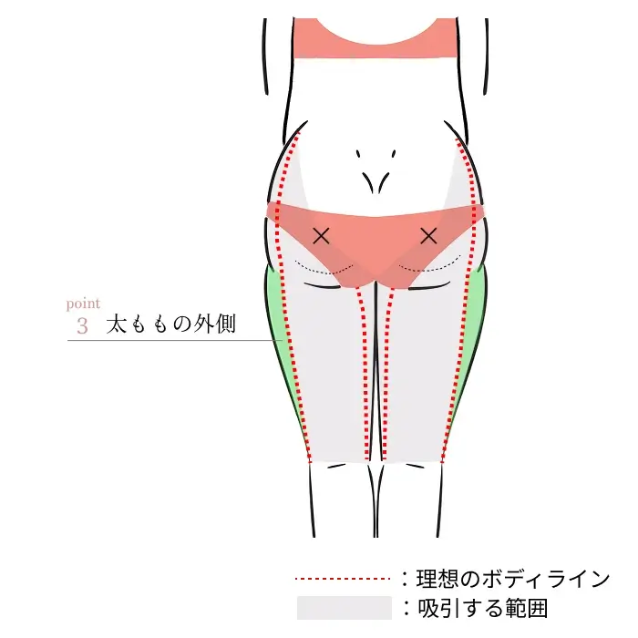 POINT3. 太ももの外側