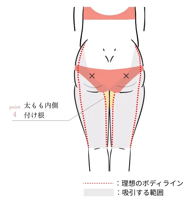 POINT4. 内股の付け根