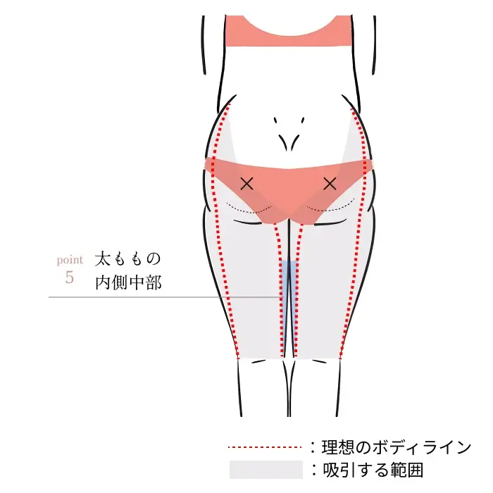 POINT5. 太ももの内側