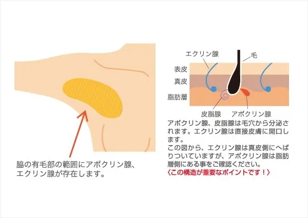 わきが・多汗症の原因となる汗腺