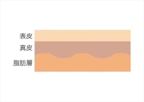 表皮は1ヶ月程で生まれ変わり、新しく再生